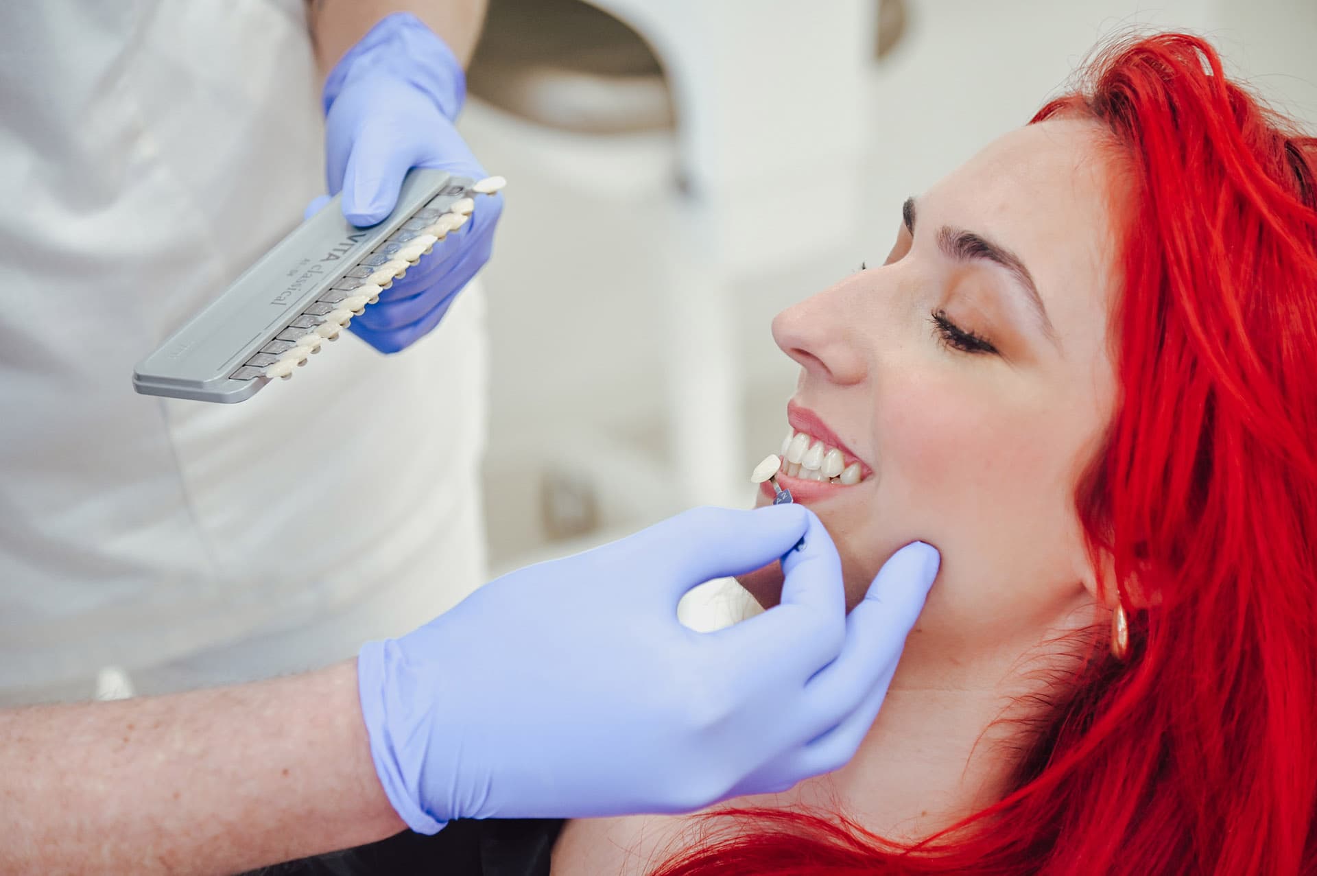 Faccette dentali