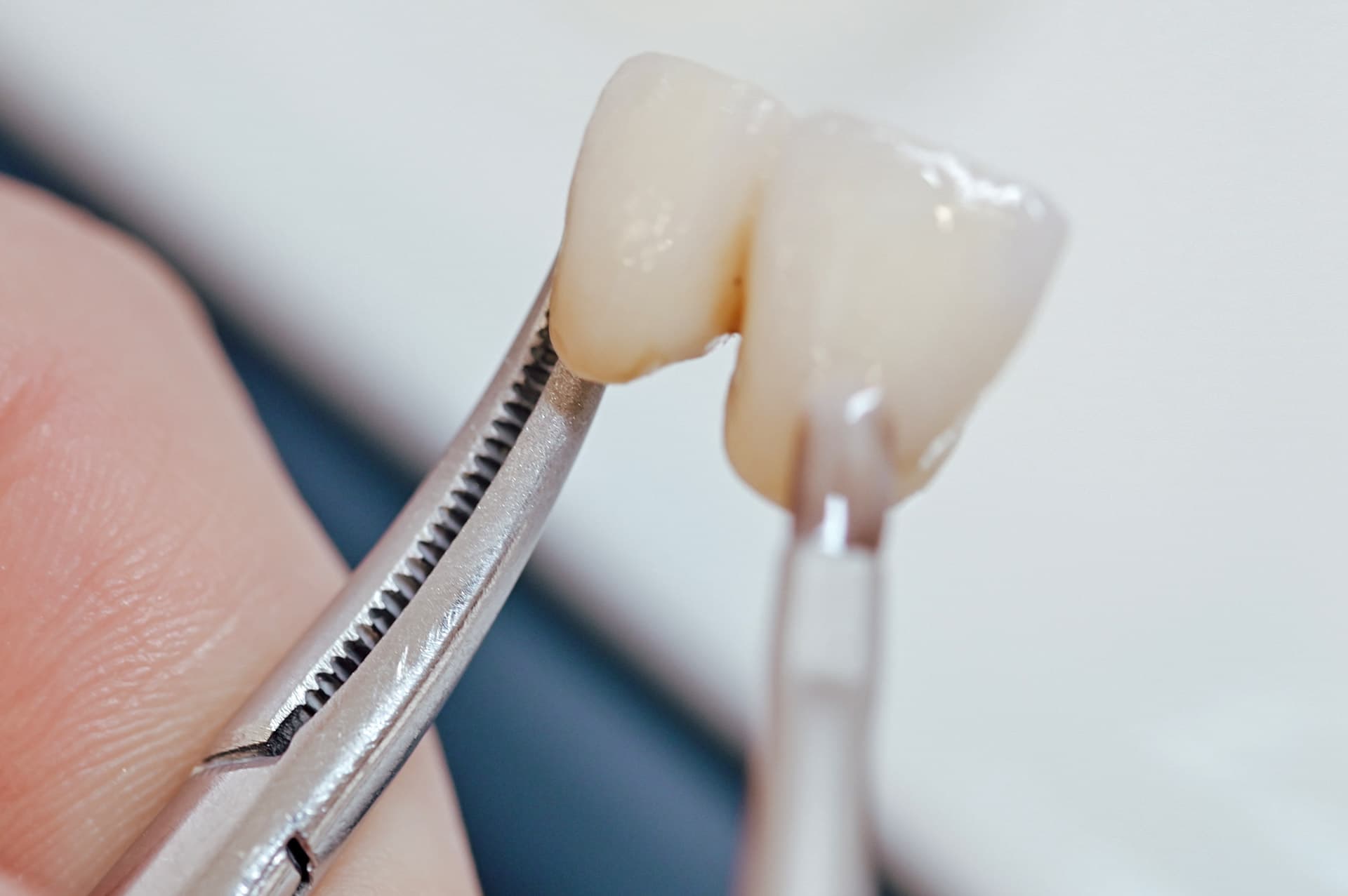 Dental Pro: Su di noi